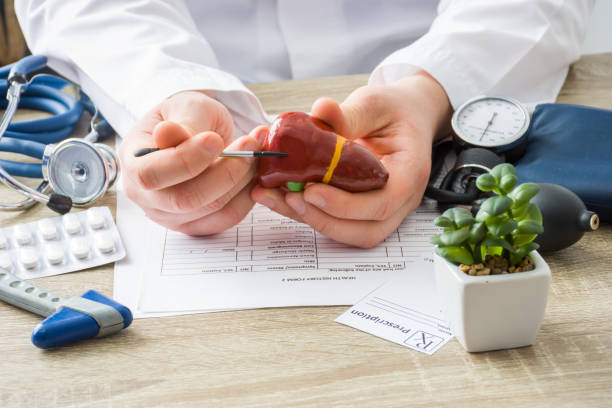 Cara Mengobati Liver Secara Alami dan Efektif